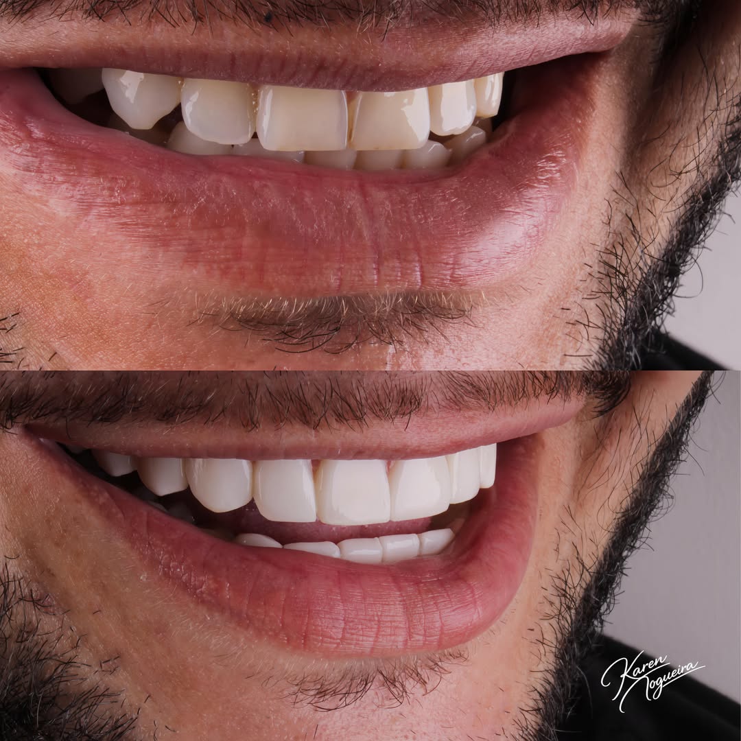 Transformar sorrisos é também transformar autoestima, confiança e pequenos detalhes que fazem um